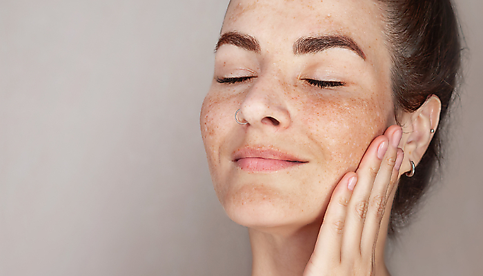 Pigmentov&eacute; &scaron;kvrny: prečo vznikaj&uacute; a čo naozaj pom&aacute;ha